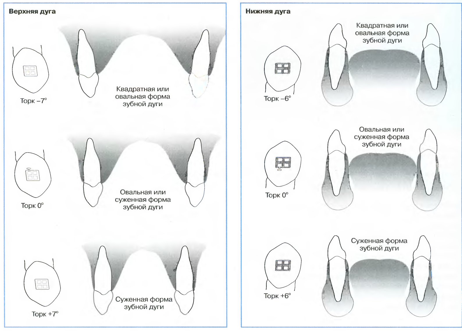 Форма зубной дуги нижней челюсти